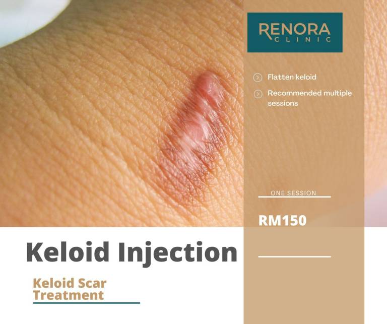 PROMO - KELOID INJECTION