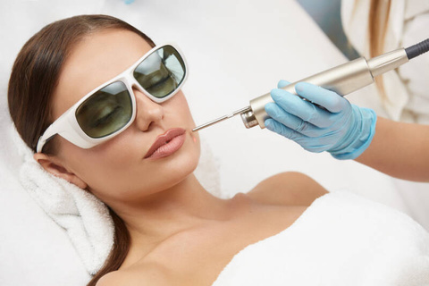 Fotona 4D Facelift Laser Treatment