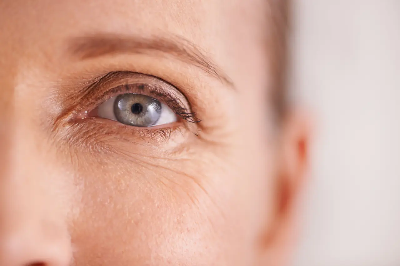 Fine lines and wrinkles