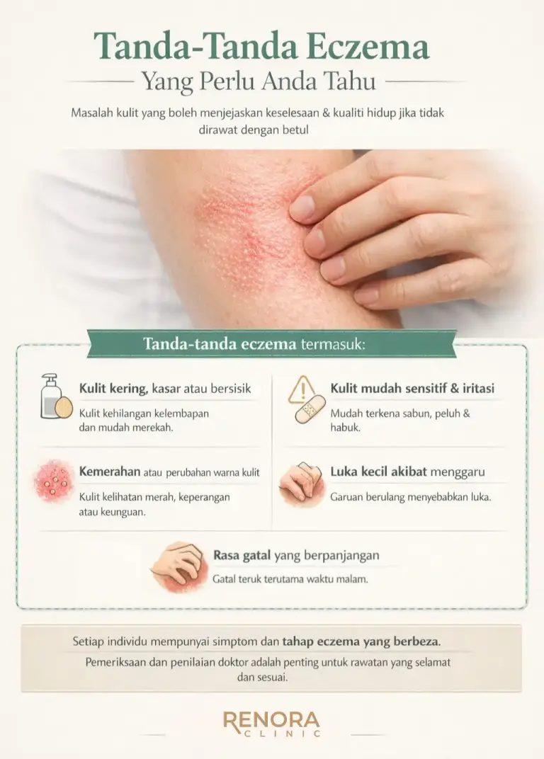 Tanda-Tanda Eczema