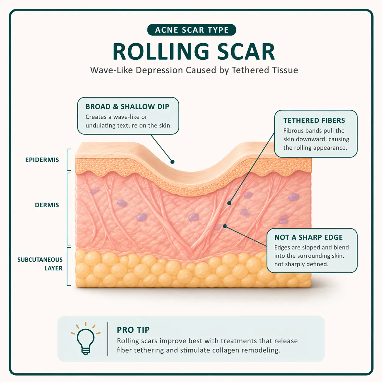 Rolling Scars