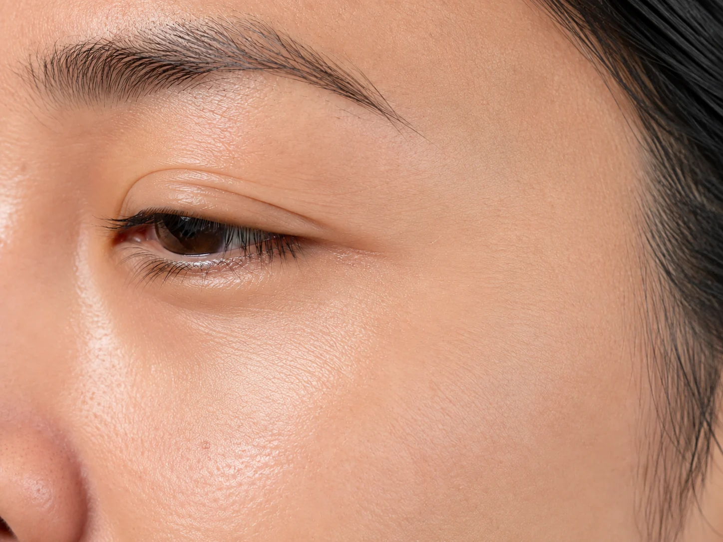 Hydration and improved skin quality for thin under-eye skin