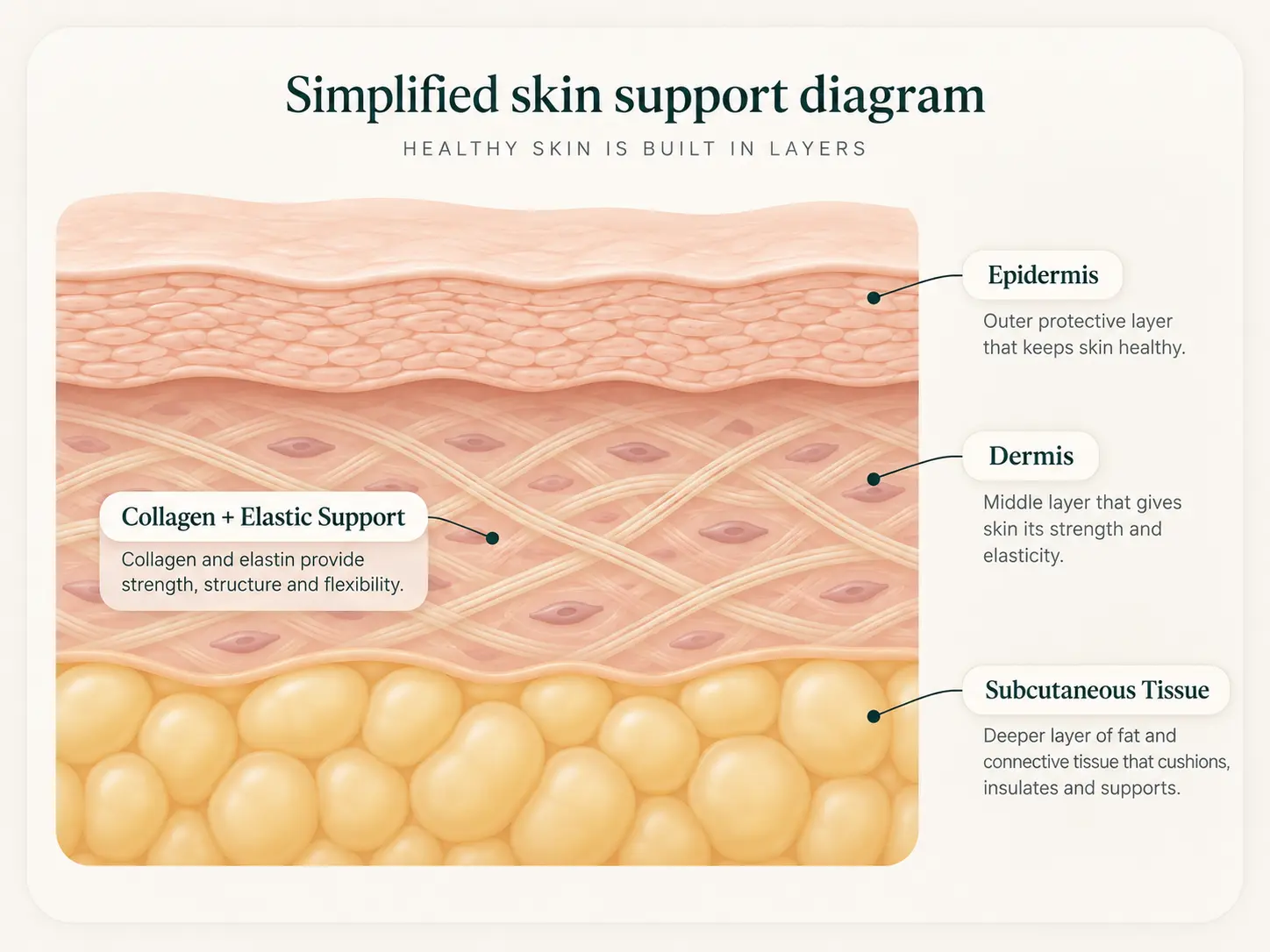 Illustration showing skin layers, collagen, elastin and subcutaneous tissue