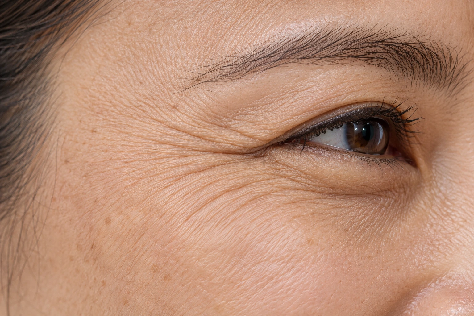Crow's feet and fine lines around the eyes
