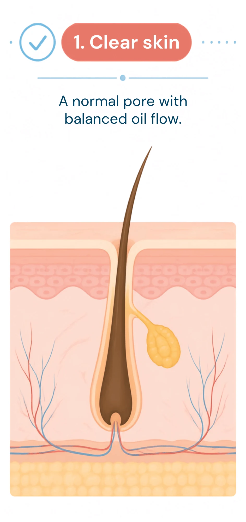 Illustration of a normal healthy skin pore with balanced oil flow