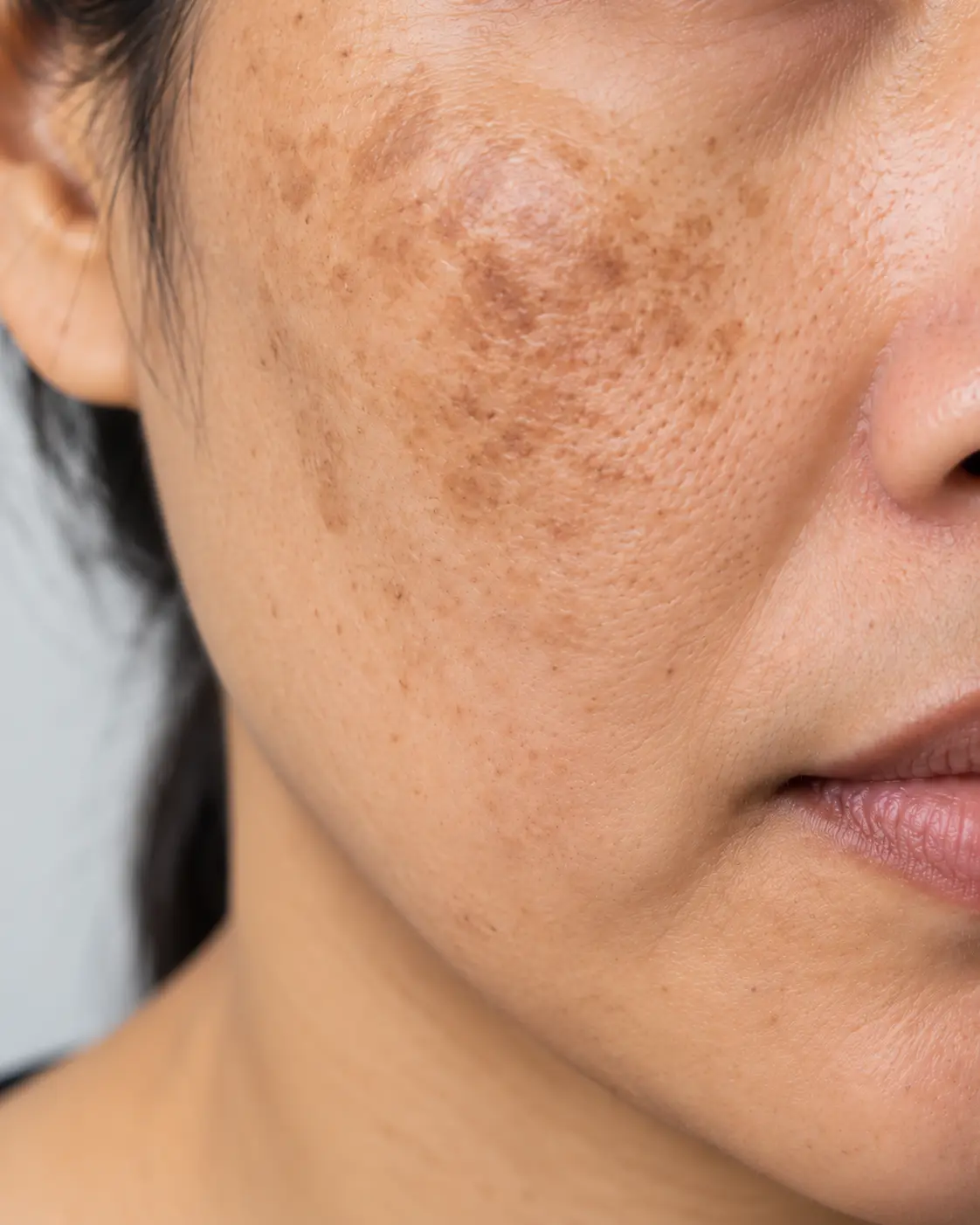 Natural portrait representing gentle skin and pigmentation care